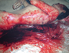 Ngaba Killed Protester